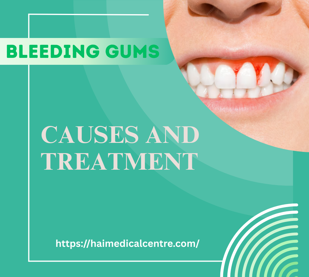 Causes and Treatment if Bleeding Gums in Kolkata, Baruipur