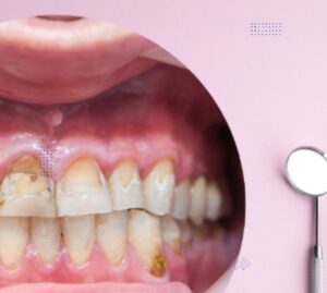 7 Common Dental Problems and How to Prevent Them