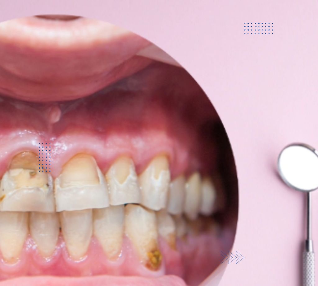 7 Common Dental Problems and How to Prevent Them