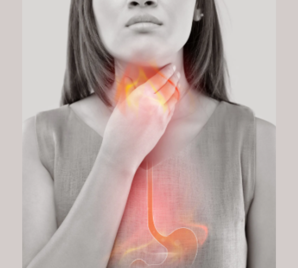 Acid Reflux and GERD Treatment
